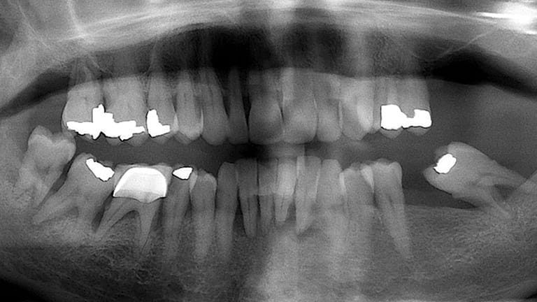 Before Extreme Makeover Benefits