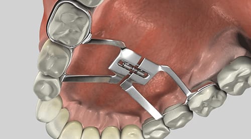 Childrens Common Questions