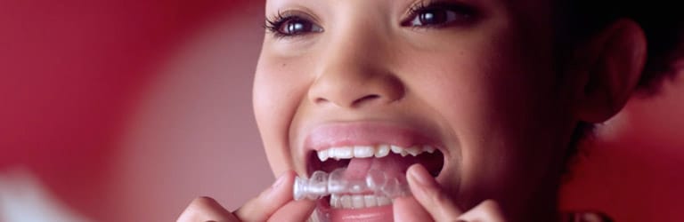 girl with invisalign